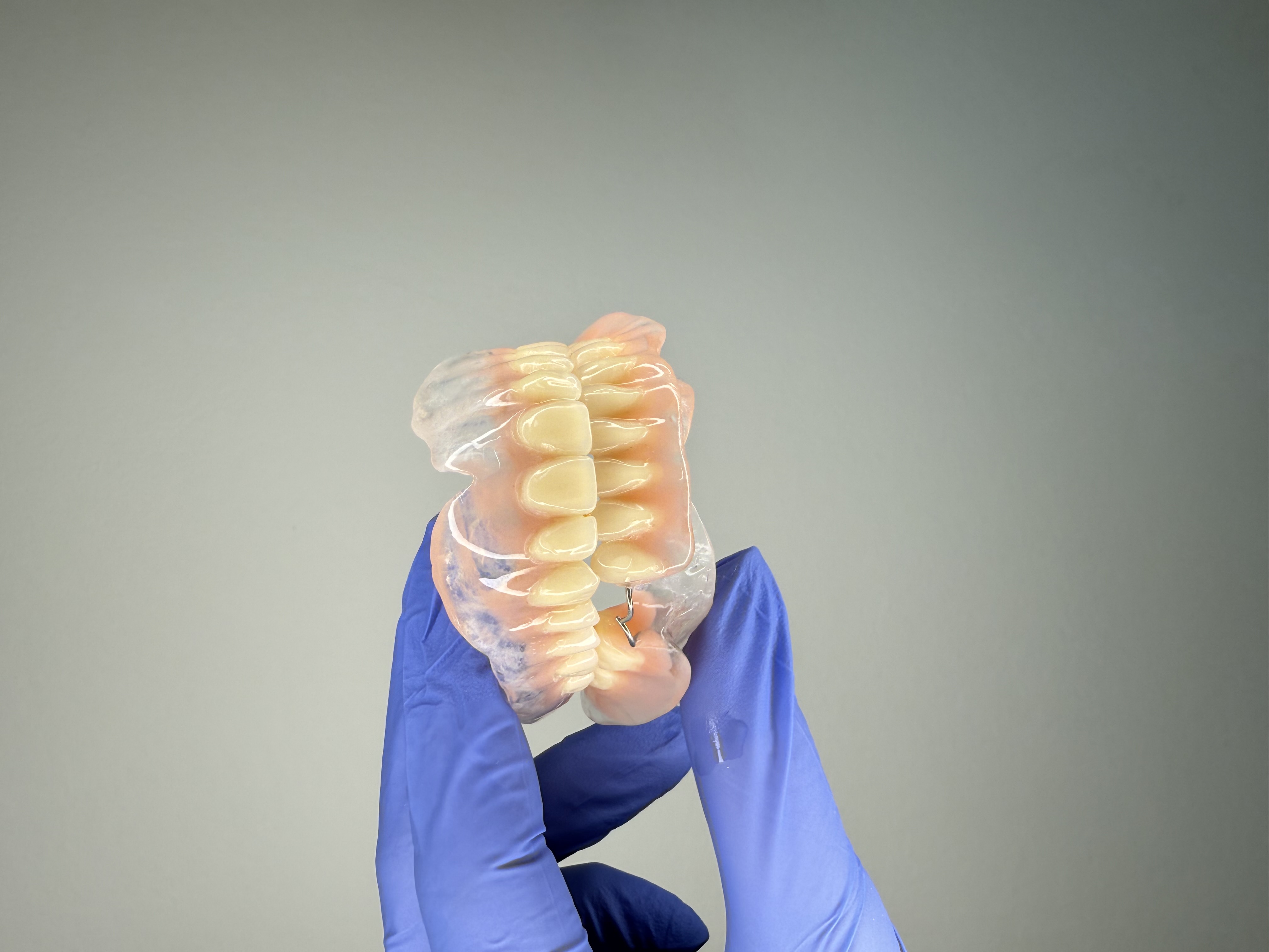 Горња тотална акрилатна протеза, 3. фебруар 2024. Дуњадент